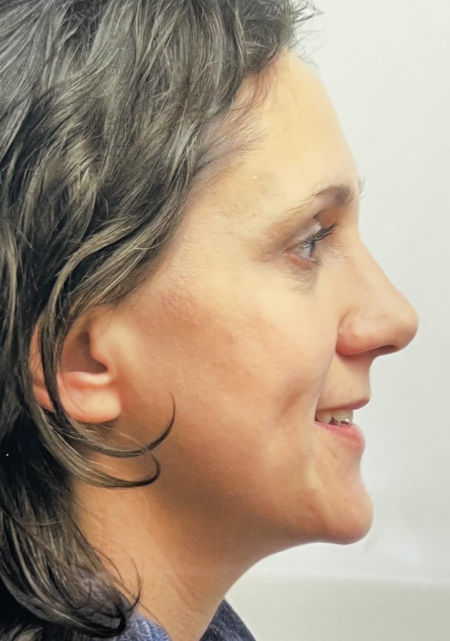 Case Study 86 after