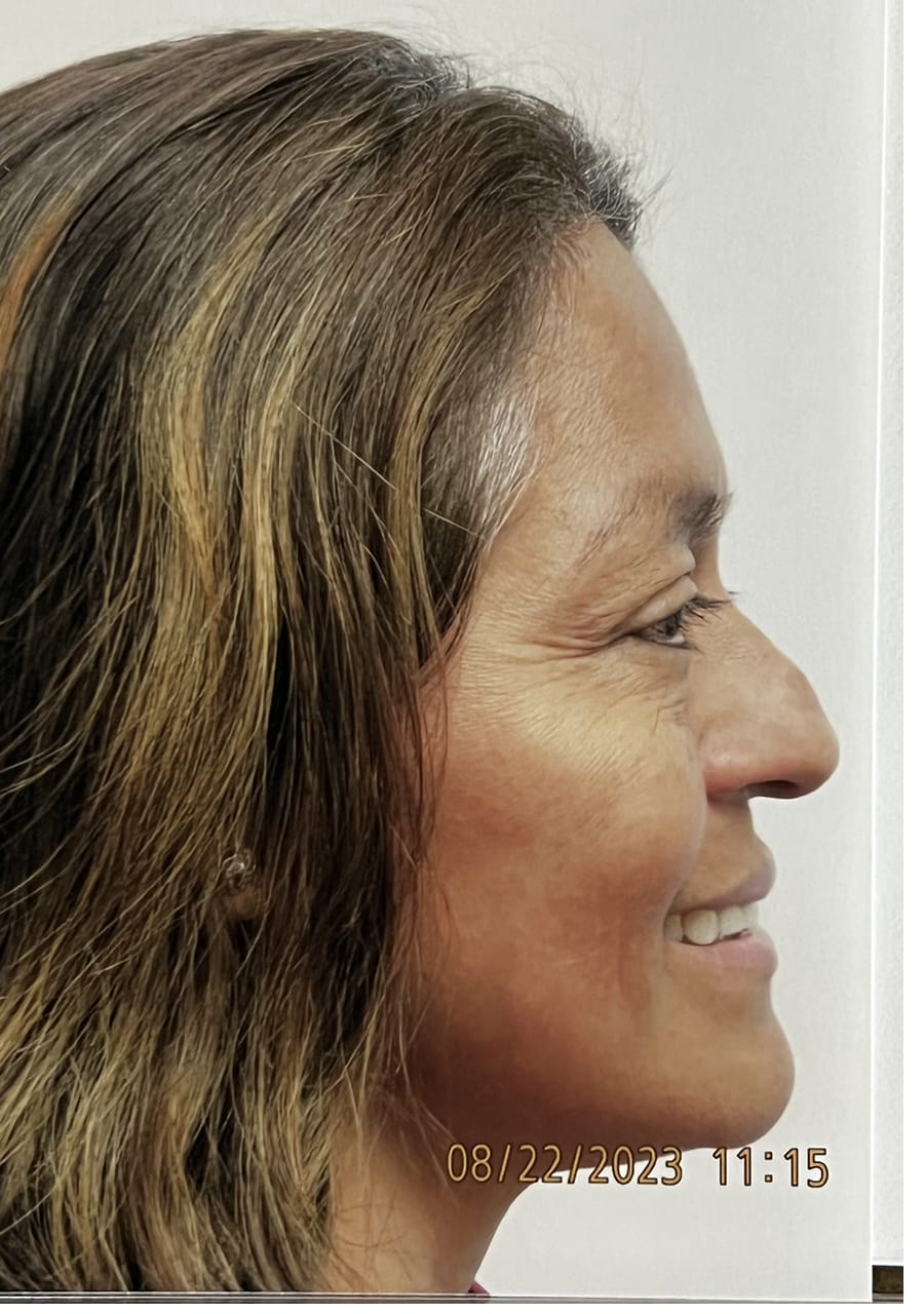 Case Study 151 — before and after