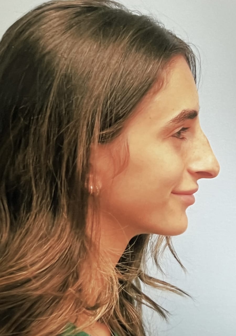 Case Study 126 — before and after