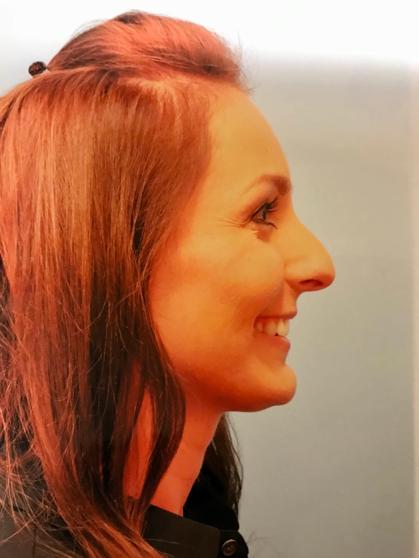Case Study 7 — before and after