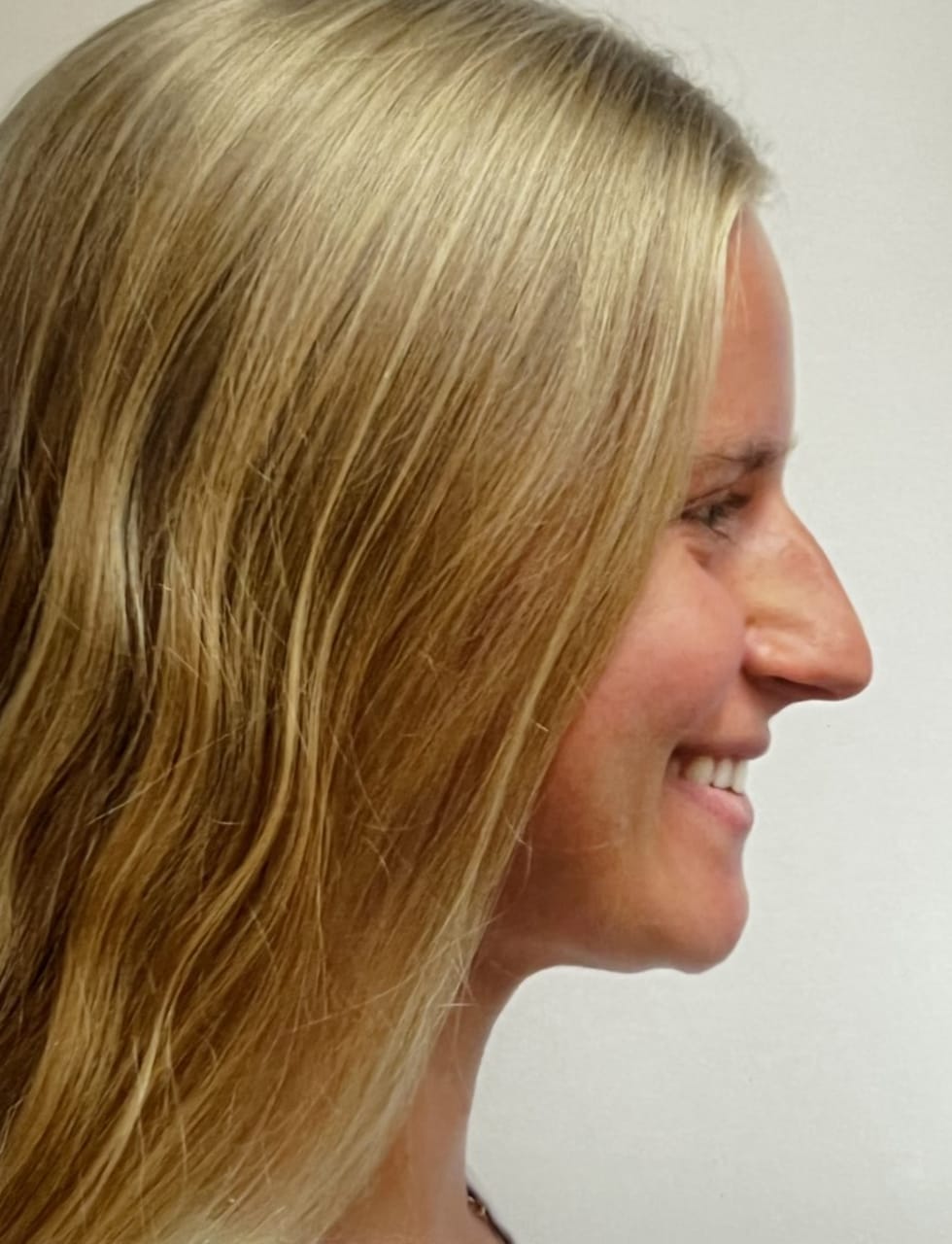 Case Study 73 — before and after