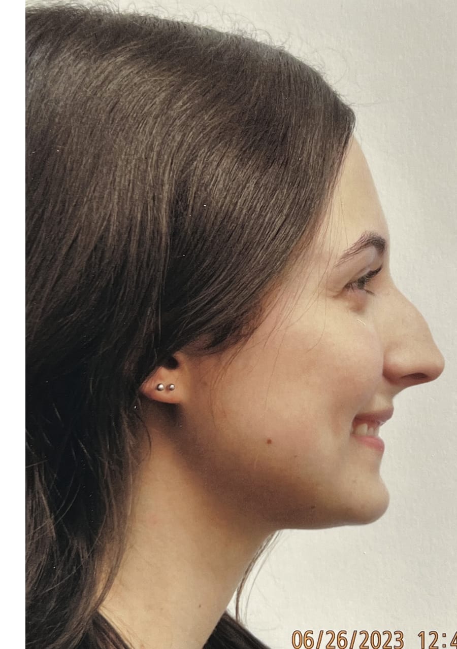 Case Study 138 — before and after