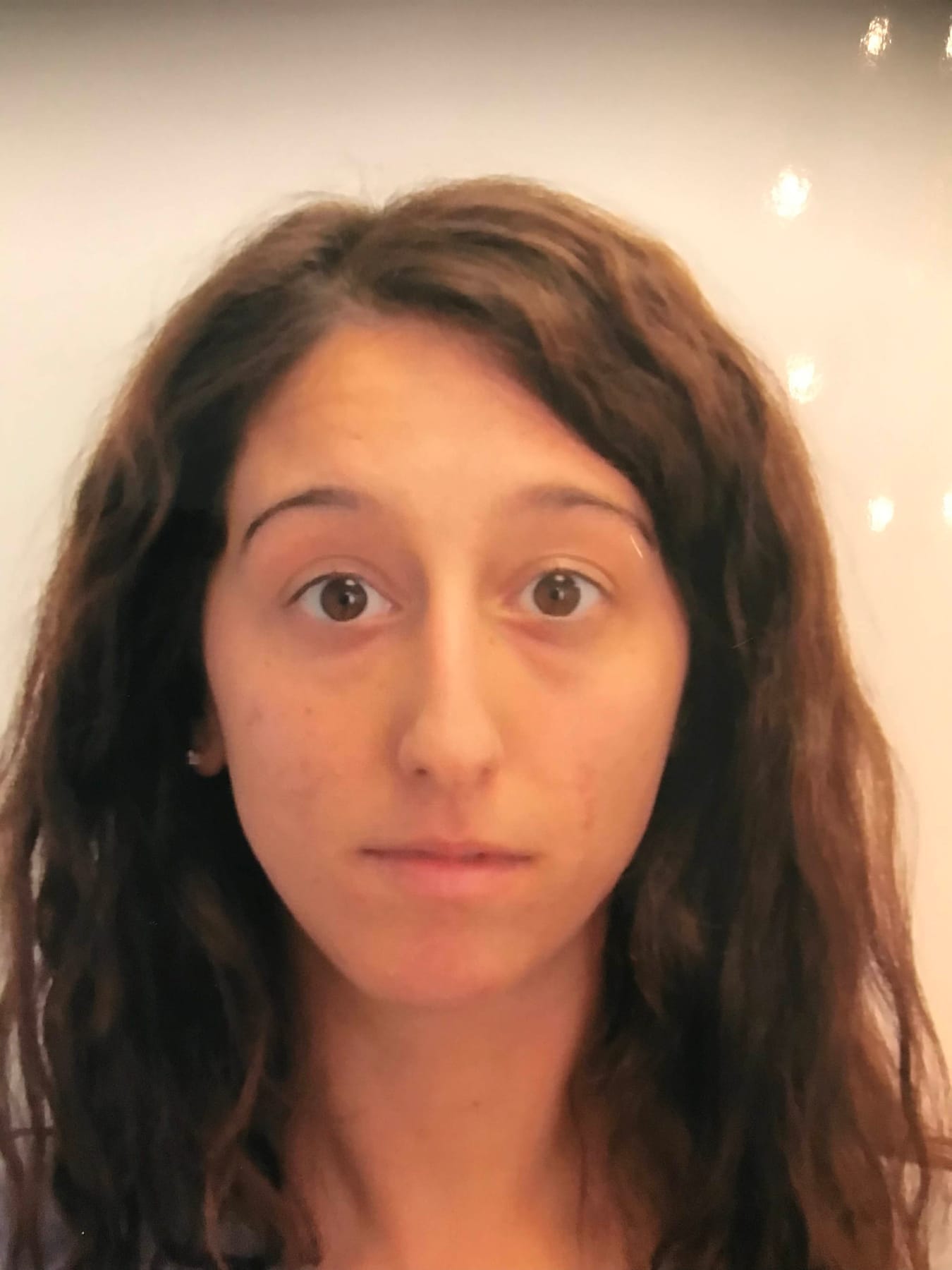 Case Study 21 — before and after