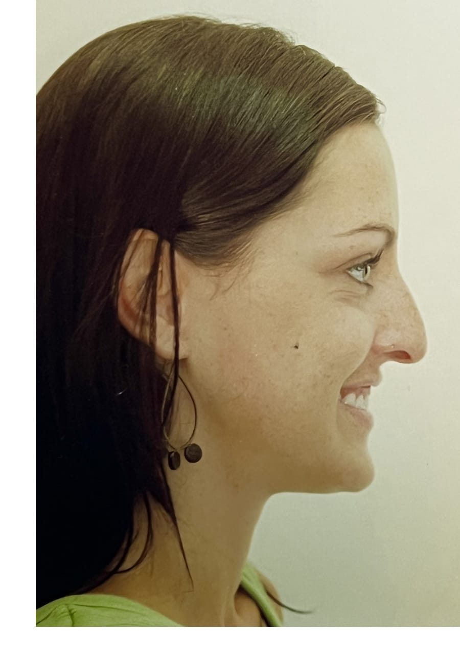 Case Study 148 — before and after