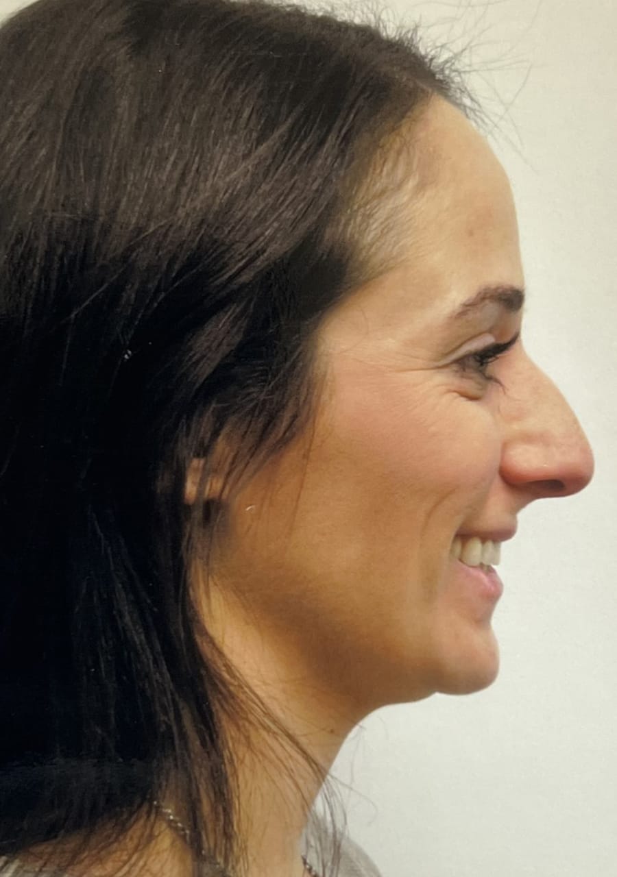 Case Study 81 — before and after