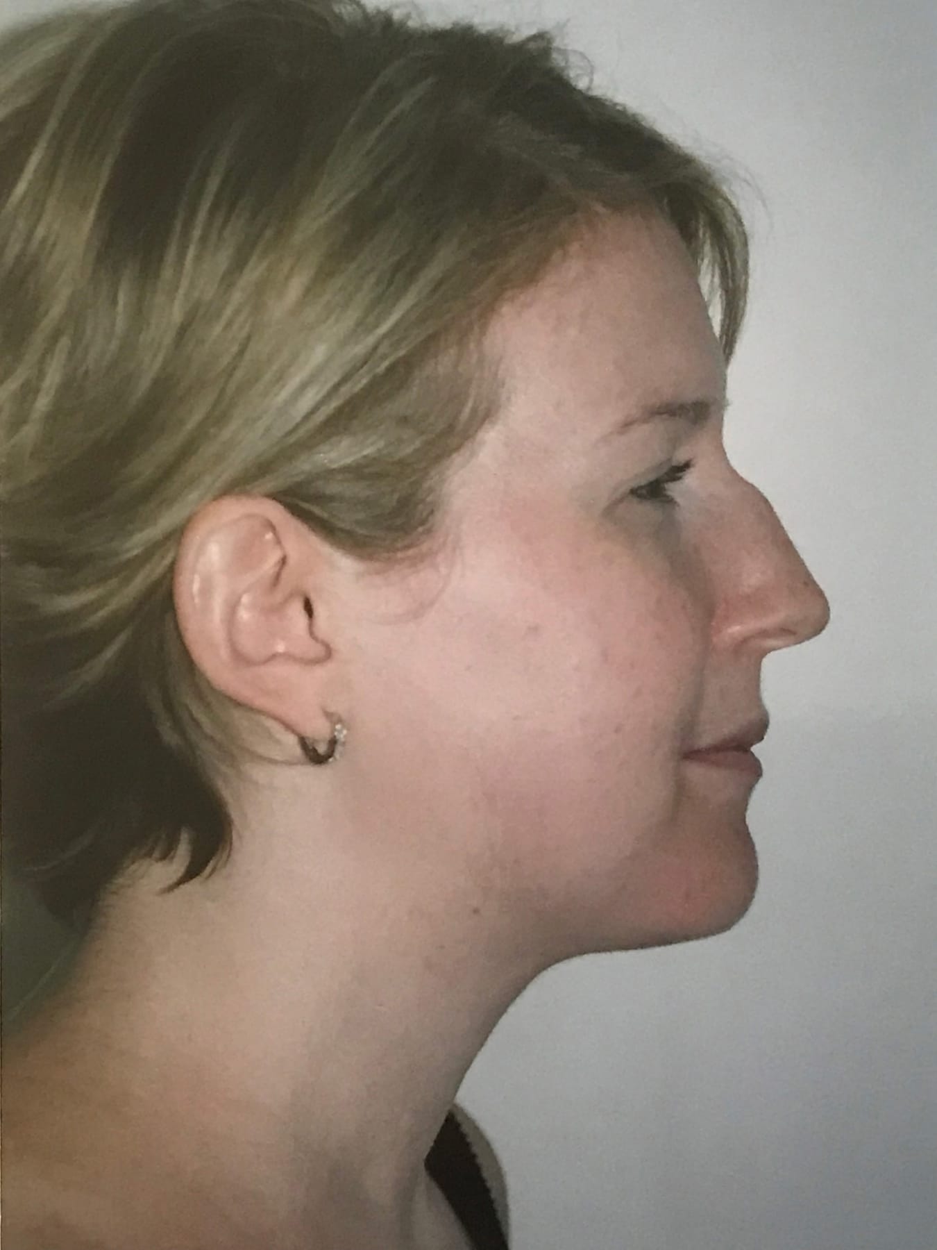 Case Study 22 — before and after