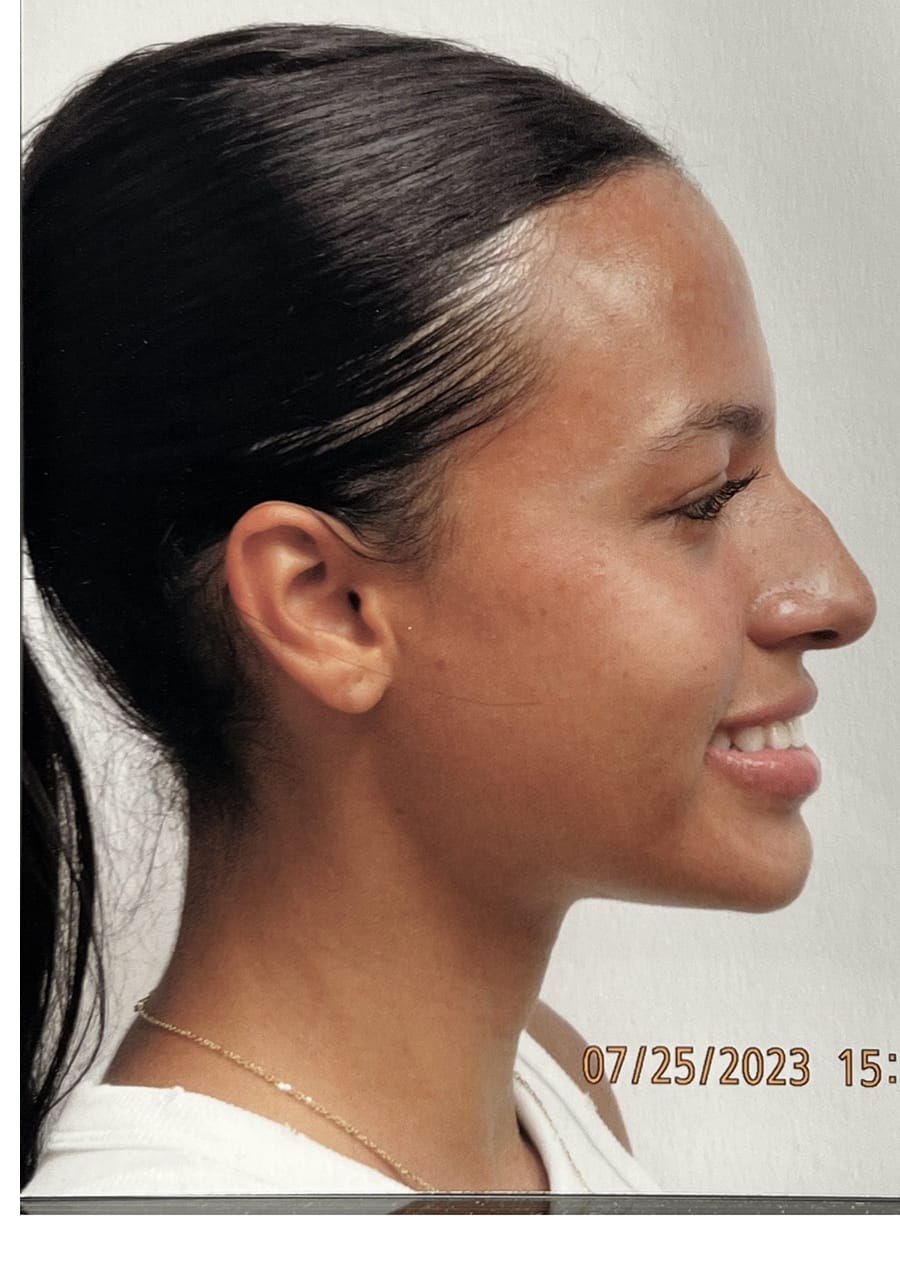 Case Study 143 — before and after