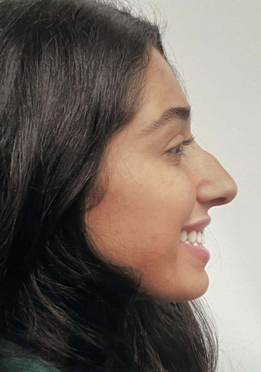 Case Study 80 — before and after