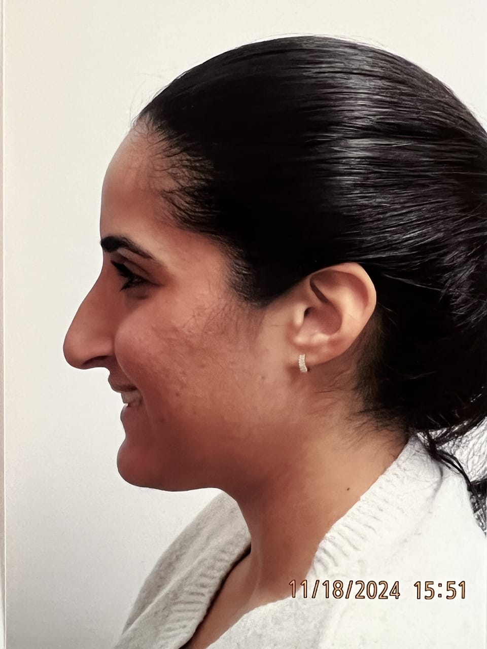 Case Study 247 — before and after