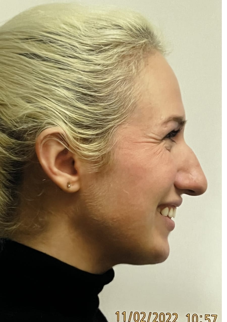 Case Study 149 — before and after