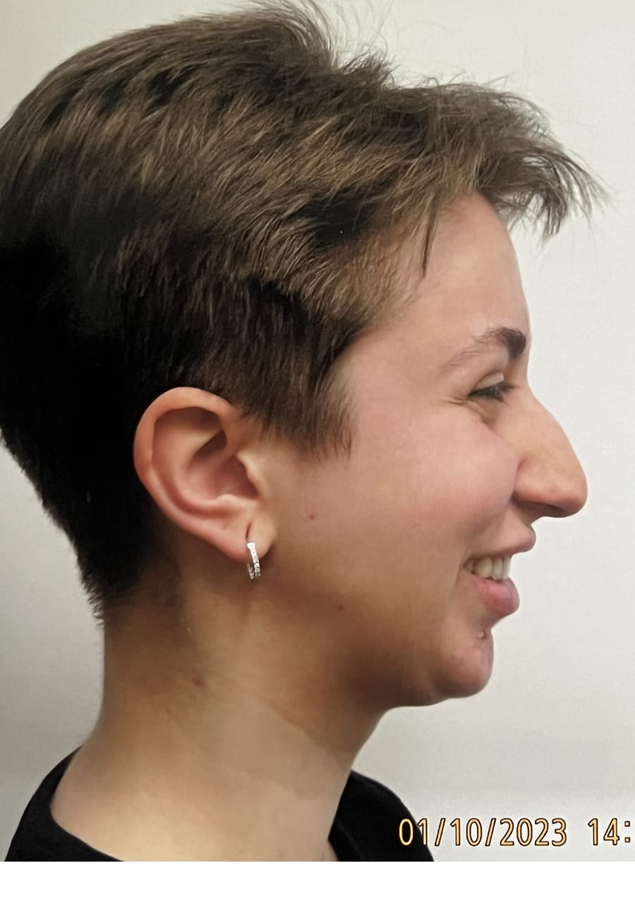 Case Study 140 — before and after