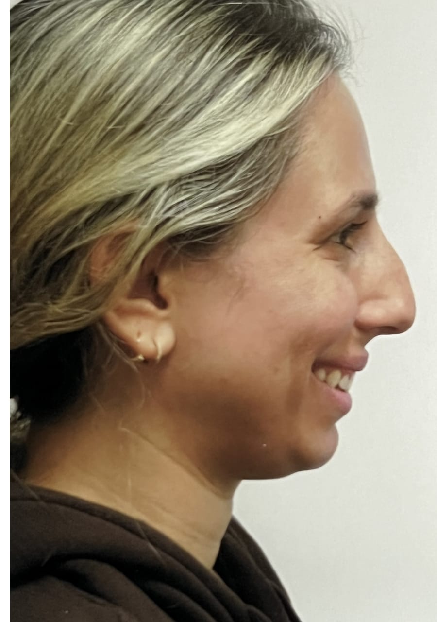 Case Study 126 — before and after