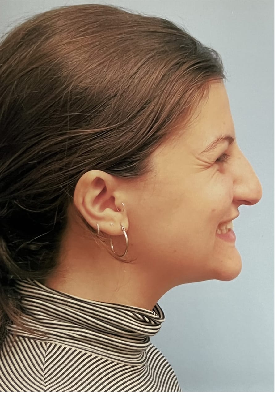 Case Study 125 — before and after