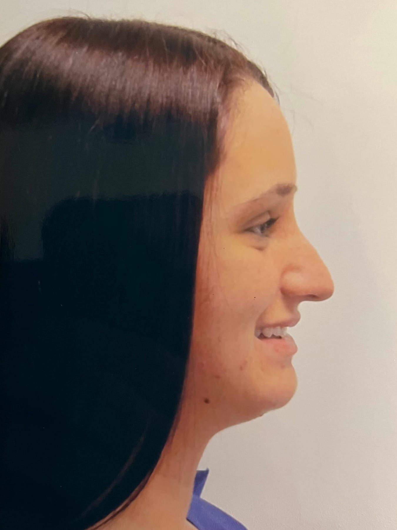 Case Study 12 — before and after