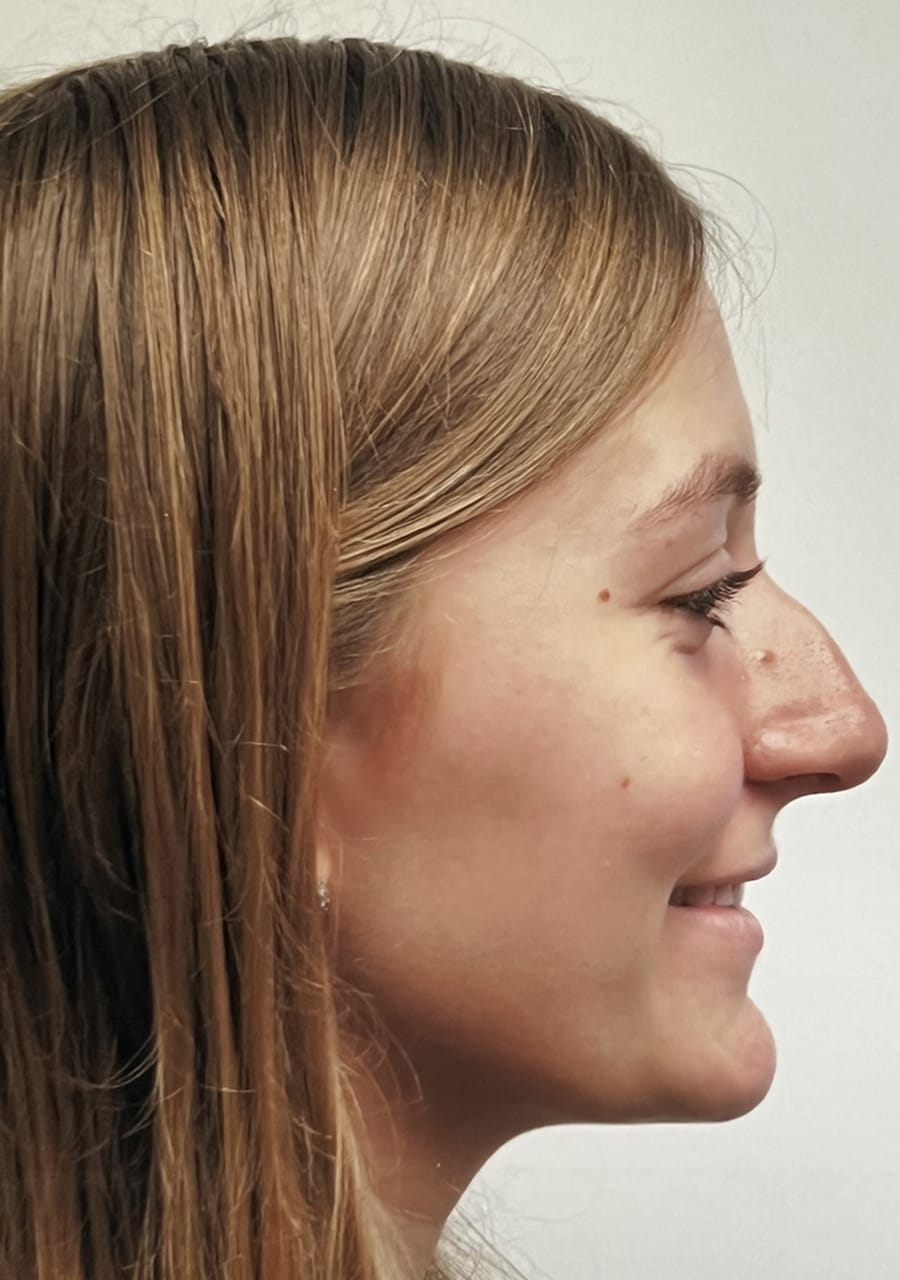 Case Study 116 — before and after