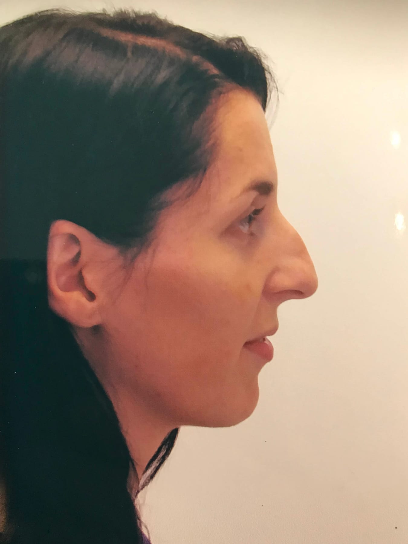 Case Study 38 — before and after