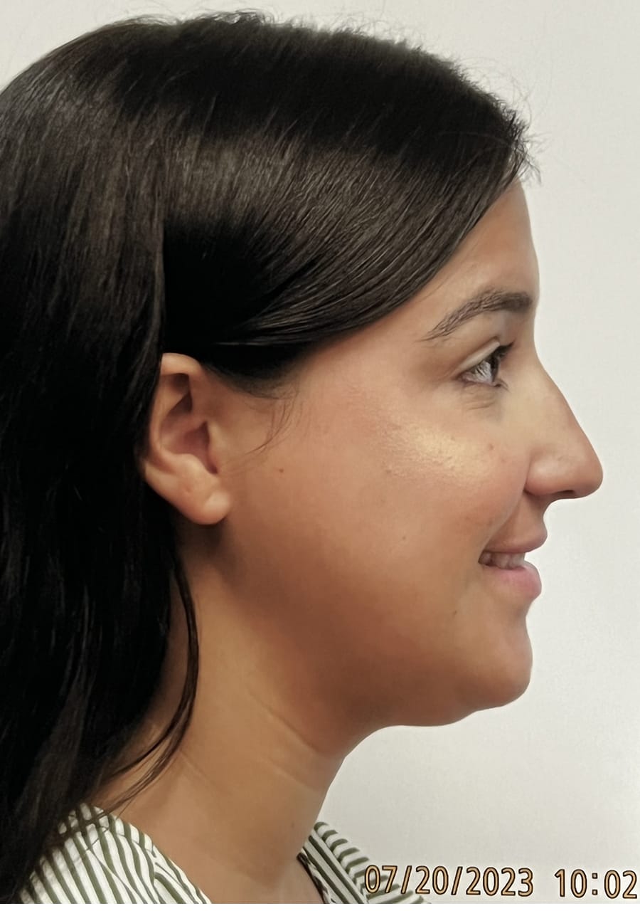 Case Study 150 — before and after