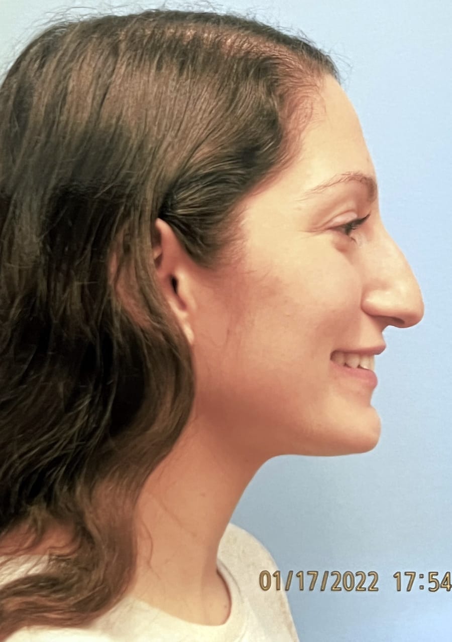 Case Study 136 — before and after