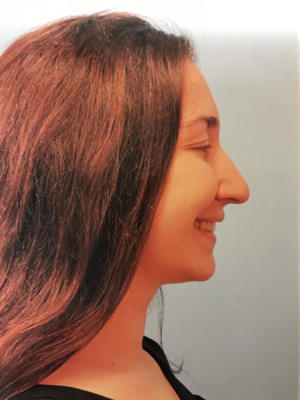 Case Study 8 — before and after