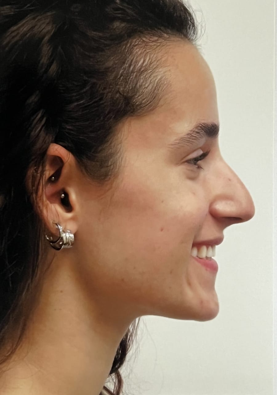 Case Study 112 — before and after