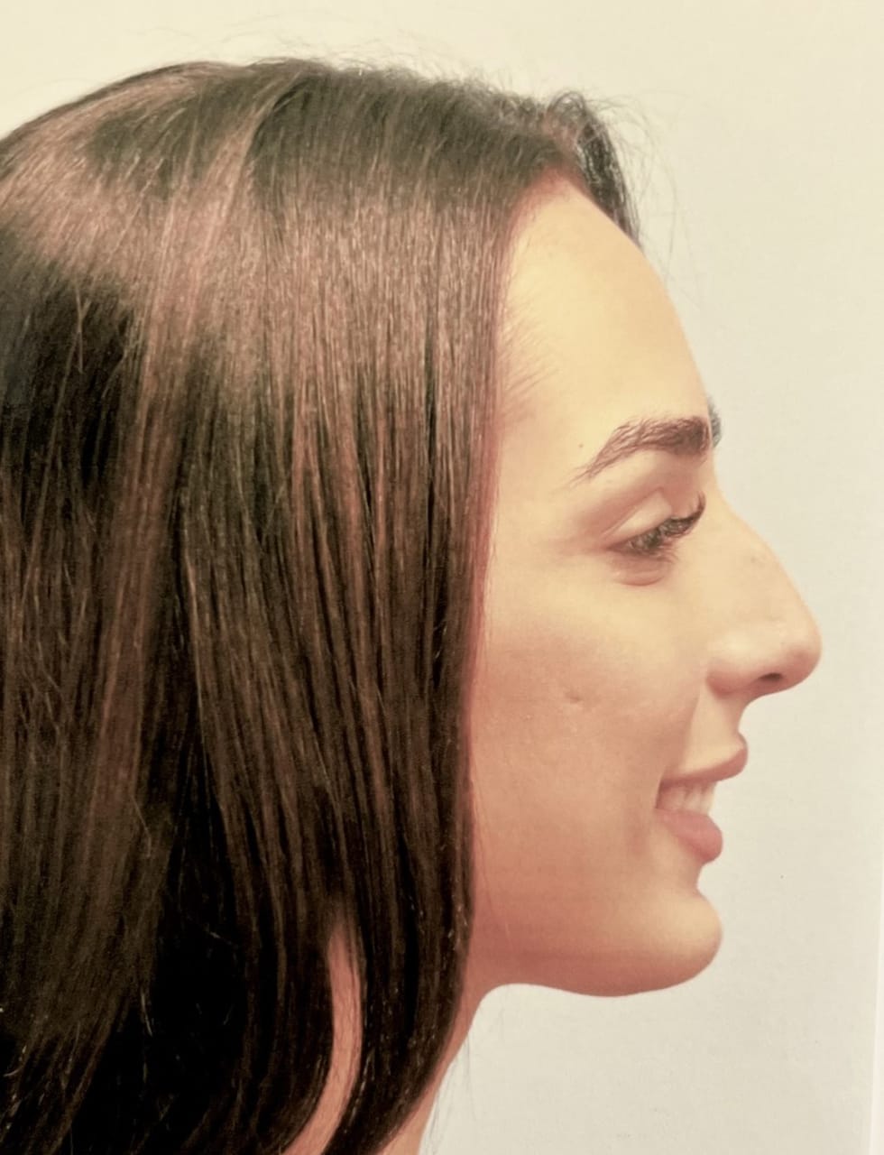 Case Study 58 — before and after