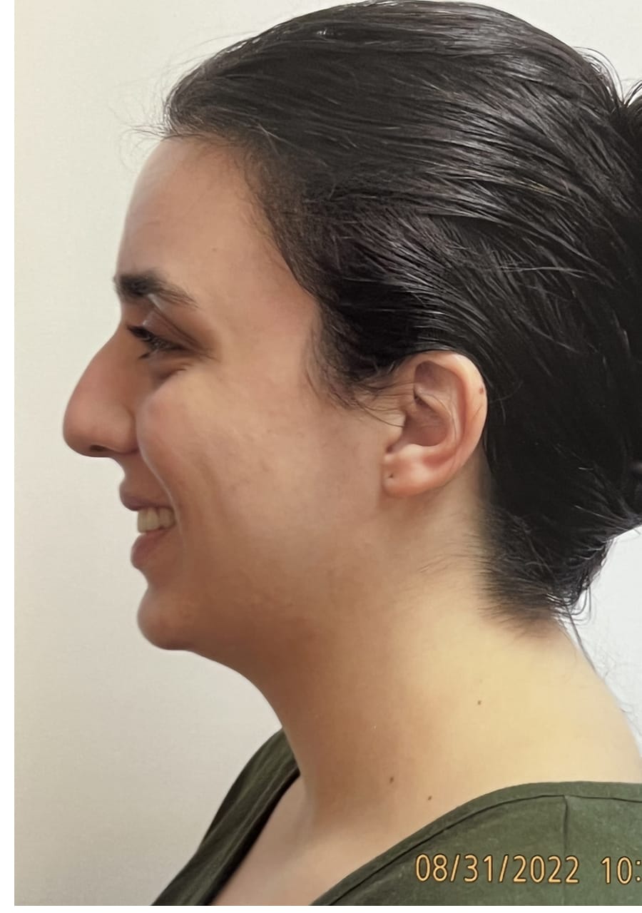Case Study 155 before
