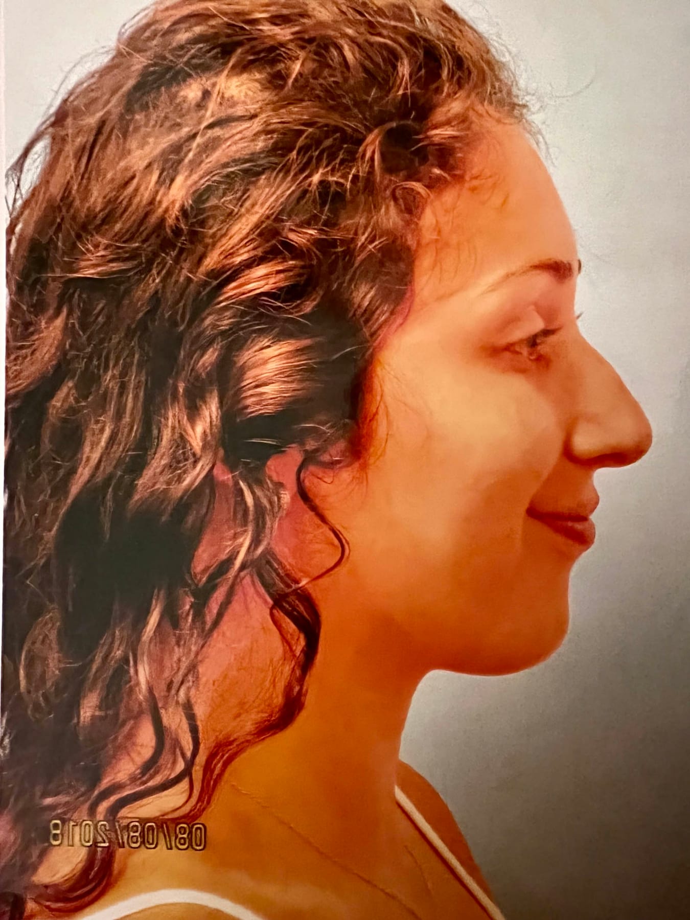 Case Study 20 — before and after