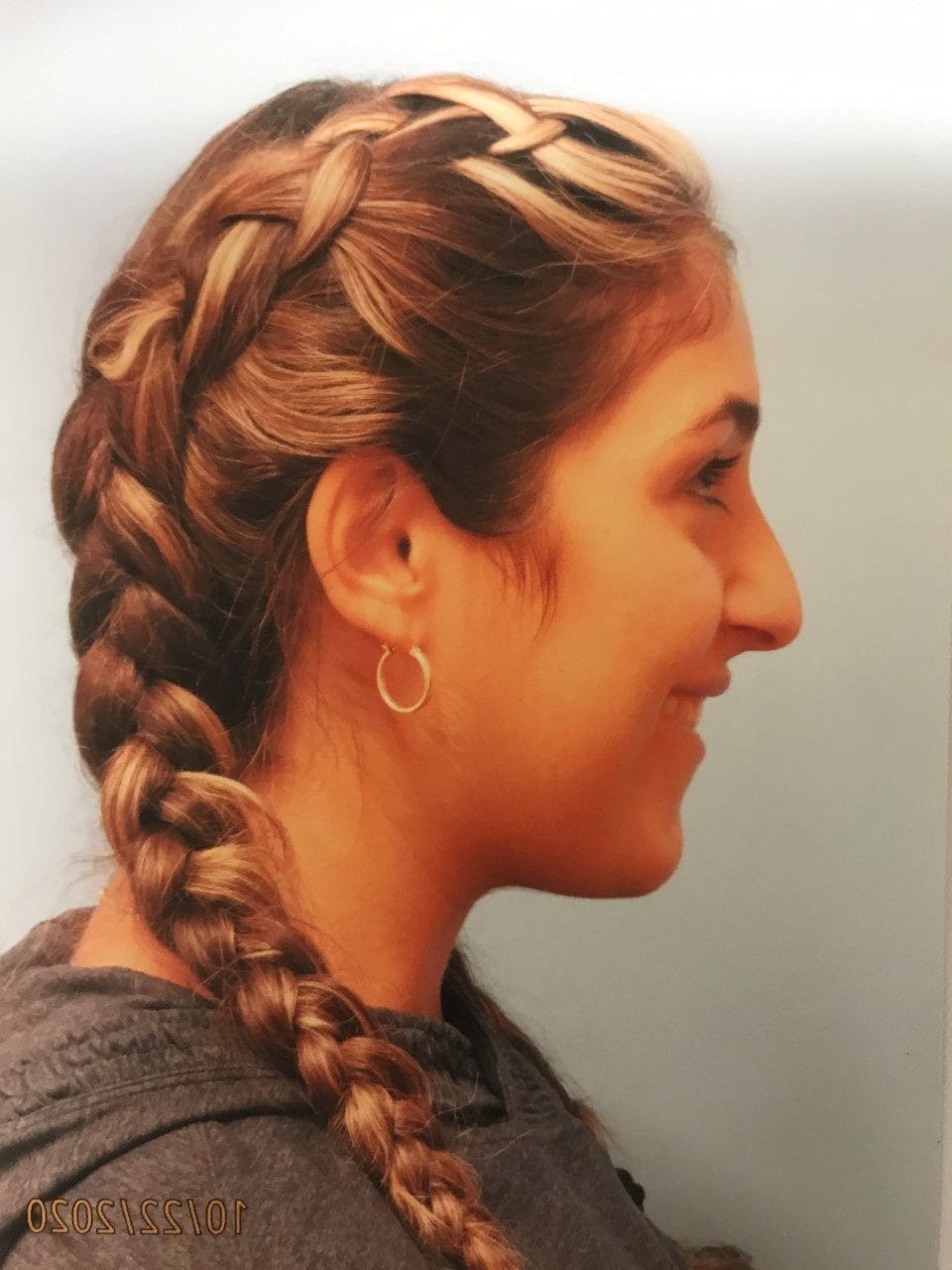 Case Study 3 — before and after